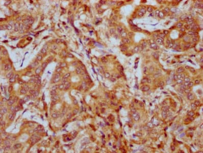 Polyclonal Rabbit anti-Human PHACTR1 Antibody (IHC, IF, WB)