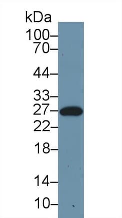 APCS / Serum Amyloid P / SAP Antibody (aa20-223, PE)