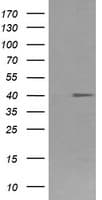 FCGR1A / CD64 Antibody (clone 3D3, Carrier-free)
