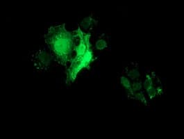 Monoclonal Mouse anti-Human SLIM / FHL1 Antibody (clone OTI3G7, IF, WB)