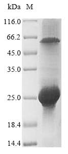 Rotavirus A Non-structural Glycoprotein 4 (Recombinant 6His, N-terminus + Myc, C-terminus)