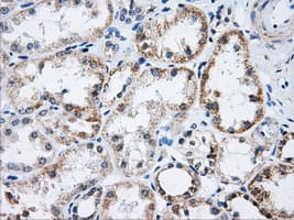 ACO2 / Aconitase 2 Antibody (clone OTI3G8)