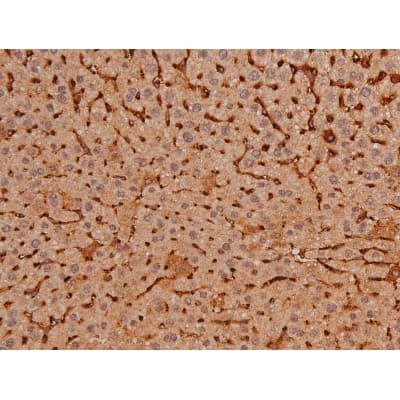 MAPT / Tau Antibody (phospho-Ser262)