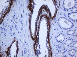 KRT5 / CK5 / Cytokeratin 5 Antibody (clone OTI6F8)