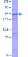 Human NAP1L5 Protein (Recombinant GST)