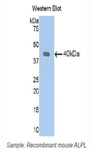 ALPL / Alkaline Phosphatase Antibody (aa18-335)