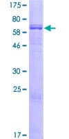 Human DGAT2 Protein (Recombinant GST)