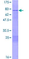 Human CPOX Protein (Recombinant GST)