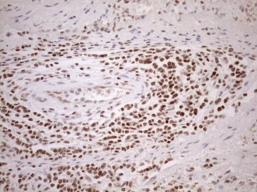 MGMT Antibody (clone OTI6C4)