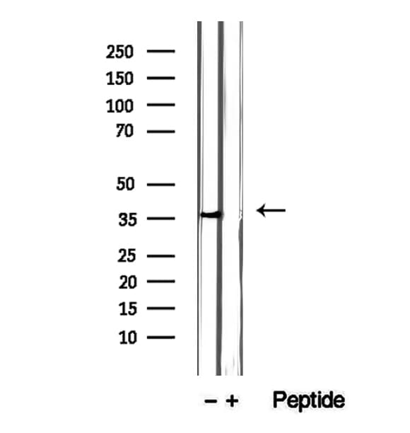Polyclonal Rabbit anti-Human ITLN1 / Omentin Antibody (IHC, IF, WB)