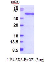 Human QTRTD1 Protein (Recombinant His)
