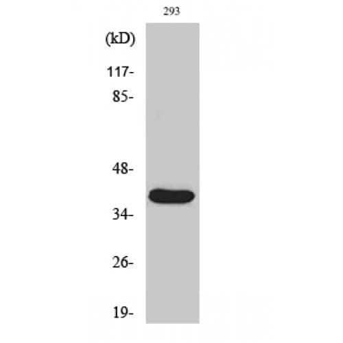 MMP23 Antibody (30-110 aa, Internal)