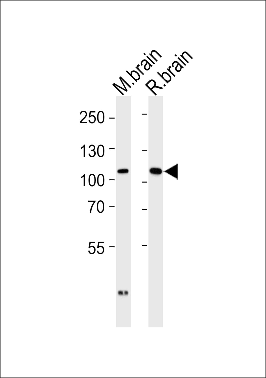 DLG2 / PSD93 Antibody (aa614-648)