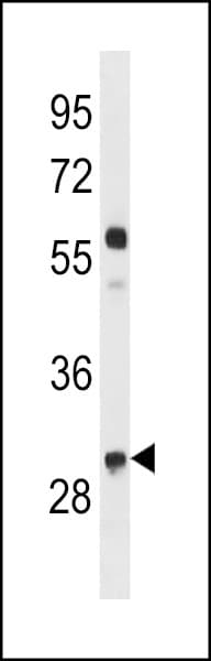 CCND2 / Cyclin D2 Antibody (aa258-285)