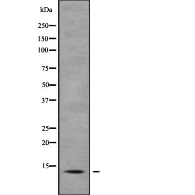 S100A7 / Psoriasin Antibody