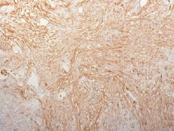 FN1 / Fibronectin Antibody (clone HFN7.1, Azide-free, BSA-free)