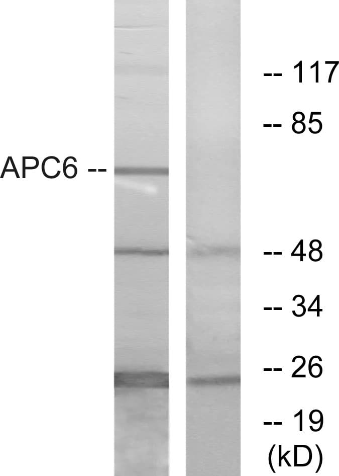 IHC-plus™ APC6 / CDC16 Antibody (aa181-230)