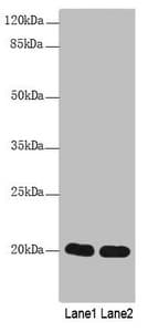 CABP5 Antibody