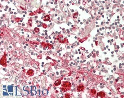 IHC-plus™ SEPT2 / Septin 2 Antibody (aa87-136)