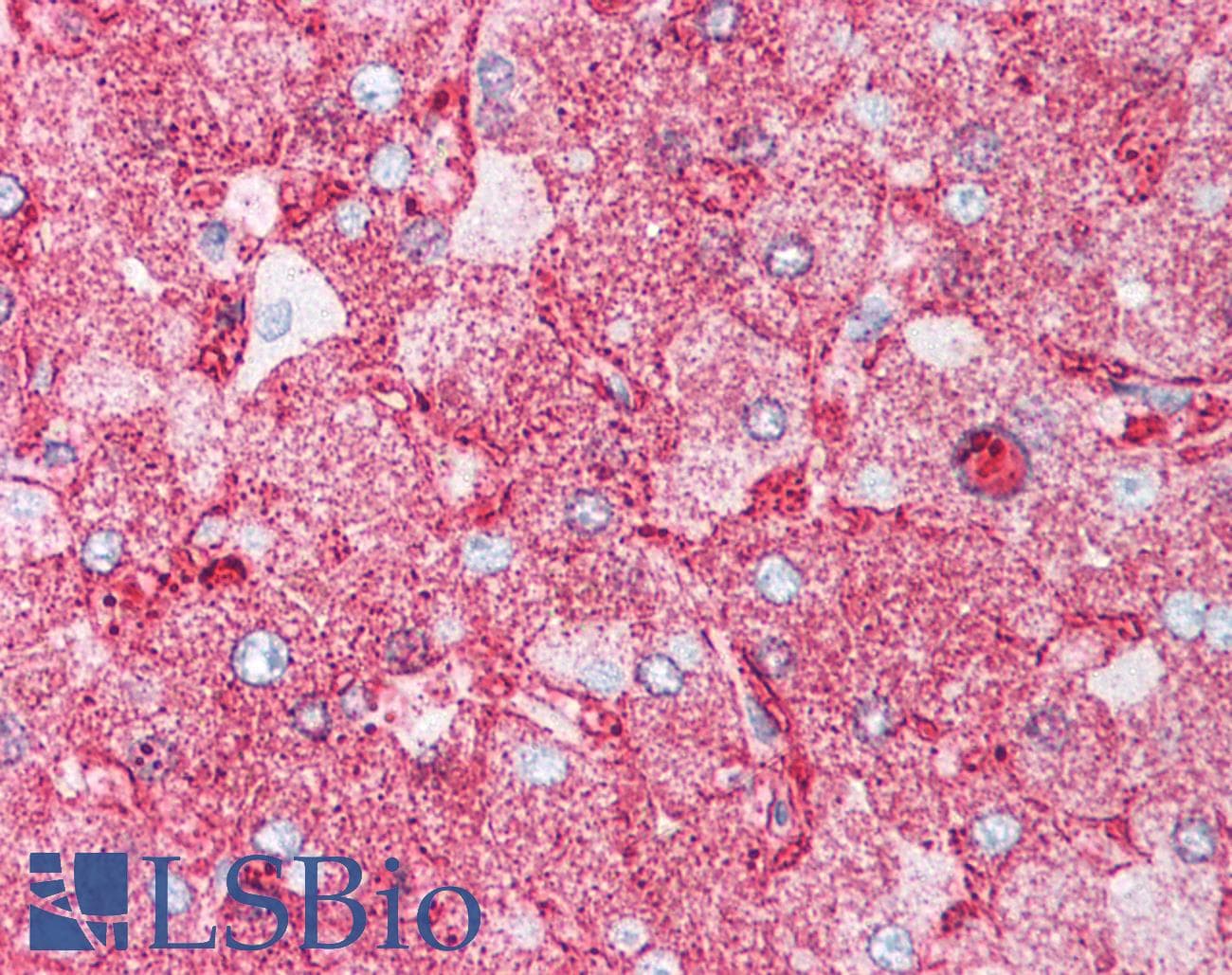 IHC-plus™ MINK1 / MINK Antibody (Internal)