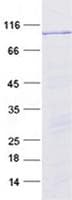 Human POLA2 / DNA Polymerase Alpha 2 Protein (Recombinant GST, N-terminus + His, C-terminus)