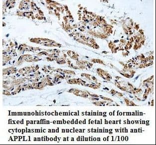 Polyclonal Rabbit anti-Human APPL1 / APPL Antibody (aa502-681, IHC, WB)