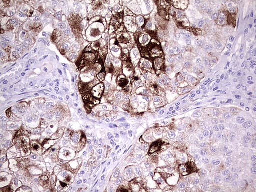 MMP7 / Matrilysin Antibody (aa95-267, clone UMAB168)