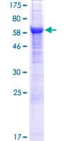 Human APMAP / C20orf3 Protein (Recombinant GST)