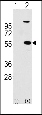 Polyclonal Rabbit anti-Human ALDH1A1 / ALDH1 Antibody (aa302-331, IHC, IF, WB)