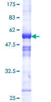 Human RCAN1 / DSCR1 Protein (Recombinant GST)