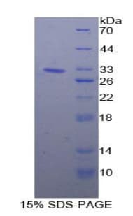 Human HSP90B1 / GP96 / GRP94 Protein (Recombinant His-T7)