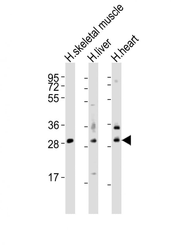 Polyclonal Rabbit anti-Human AMZ1 Antibody (aa4-39, WB)