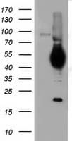 Monoclonal Mouse anti-Human CD5 Antibody (clone OTI6F7, WB)