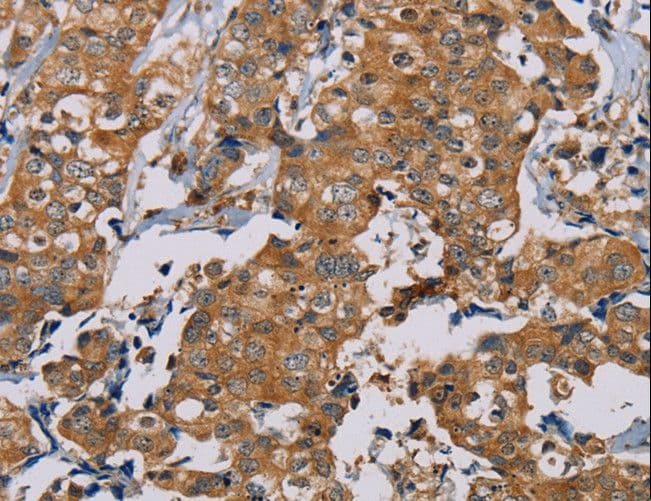 NAP1 / TAB3 Antibody