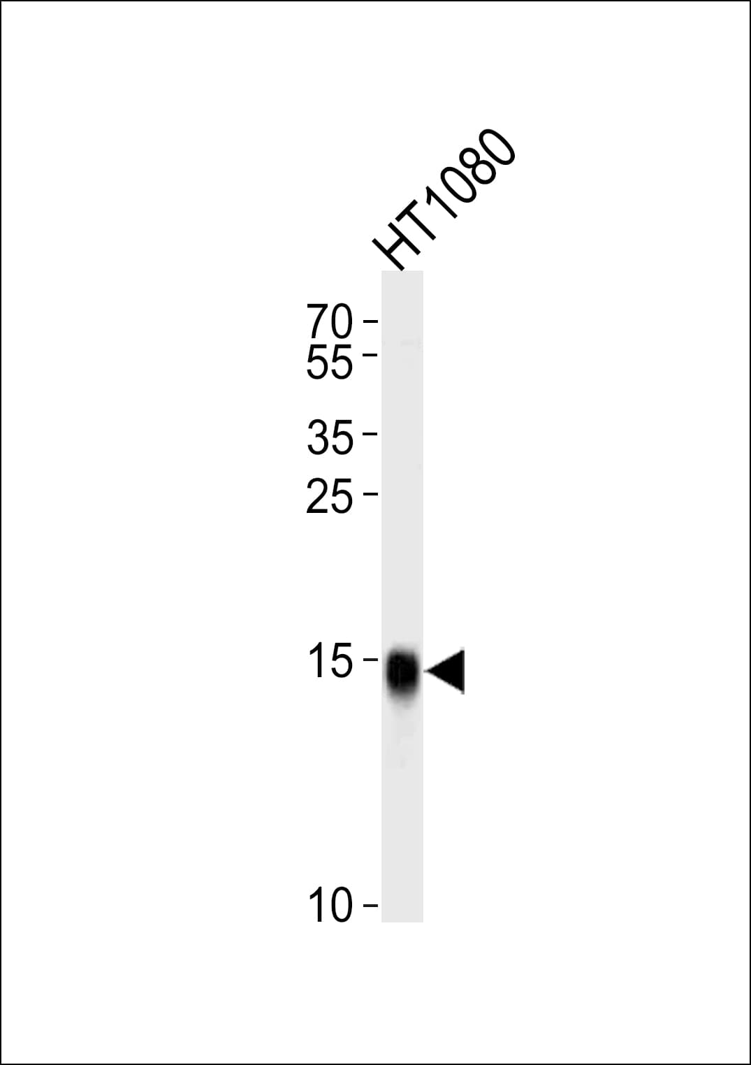 Polyclonal Rabbit anti-Human Fragilis / IFITM3 Antibody (aa1-30, IF, WB)