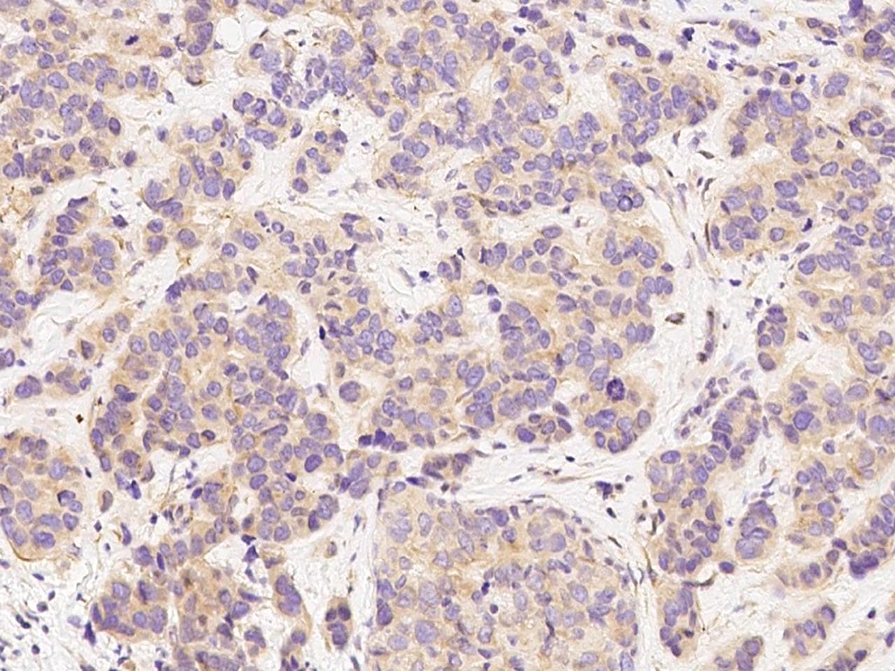 PRLR / Prolactin Receptor Antibody (Preservative Free)