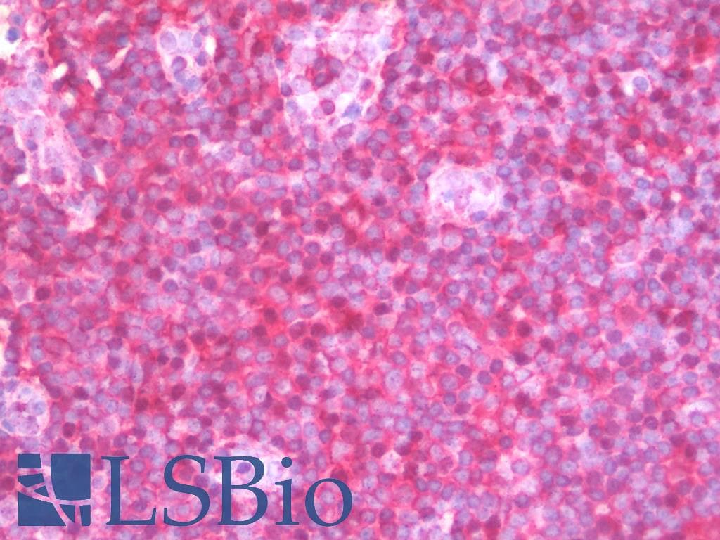 IHC-plus™ Monoclonal Mouse anti-Human PPP1CA / PP1-Alpha Antibody (N-Terminus, IHC, IF, WB)