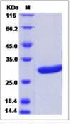 Rat Prl8a9 Protein (Recombinant His,C-terminus)