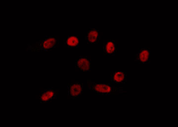 Polyclonal Rabbit anti-Human NPAS1 Antibody (IF, WB)