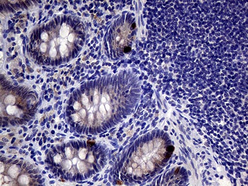 IL24 Antibody (aa52-206, clone OTI3C5)
