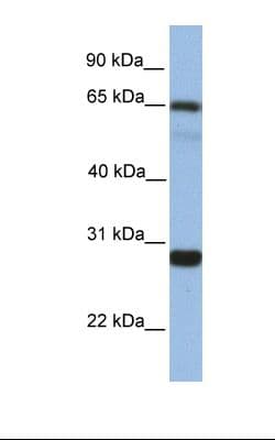 MED4 Antibody (aa146-195)