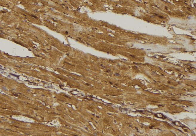 Polyclonal Rabbit anti-Human MRPL16 Antibody (IHC, IF, WB)