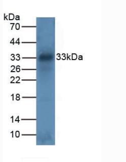 PathPlus™ Tryptase Antibody (aa161-262)