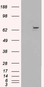 IHC-plus™ Polyclonal Goat anti-Human FANCG Antibody (aa609-622, IHC, WB)