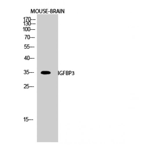 Polyclonal Rabbit anti-Human IGFBP3 Antibody (120-200 aa, IHC, WB)