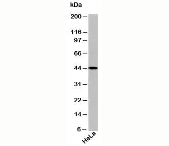 TARBP2 / TRBP2 Antibody (C-Terminus)