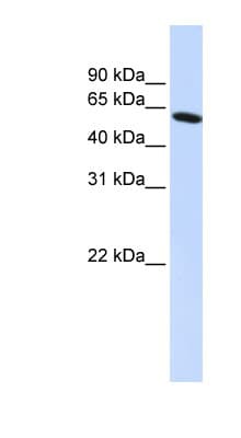 PDLIM5 / LIM Antibody (N-Terminus)