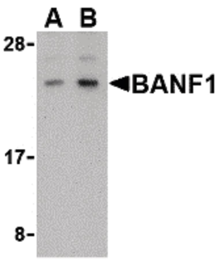 IHC-plus™ BANF1 / BAF / BCRP1 Antibody