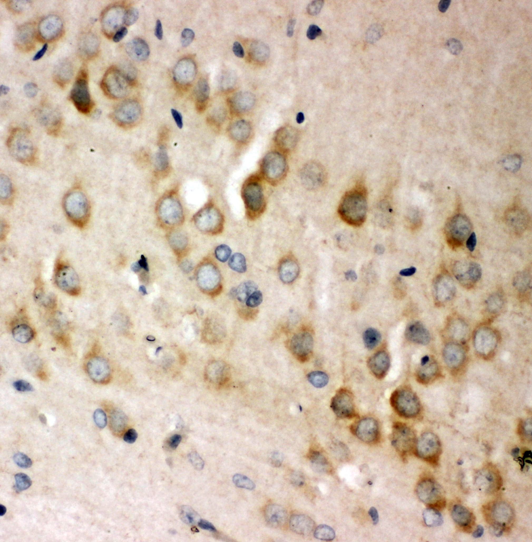 Polyclonal Rabbit anti-Human ABI1 / SSH3BP1 Antibody (aa483-494, IHC, WB)
