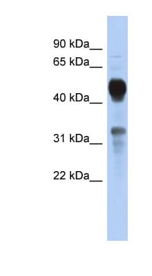 MVK Antibody (aa179-228)